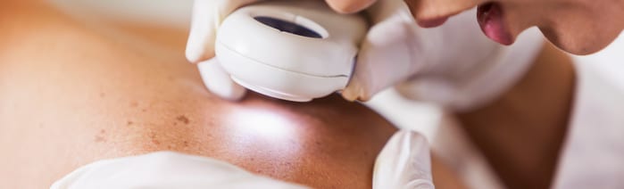 skin cancer specialist | skin cancer treatment 