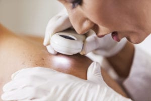 Skin Cancer Treatment Peachtree Corners GA