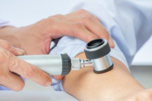 Dermatologist examines child patient birthmark with dermatoscope. 