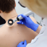 Method of dermatoscopy of skin lesions and moles.