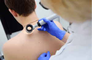 Method of dermatoscopy of skin lesions and moles. 