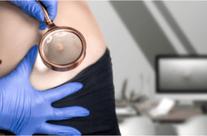 The doctor examines the growths on the woman's skin with a magnifying glass